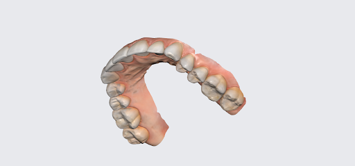 Family Dentistry - West End
