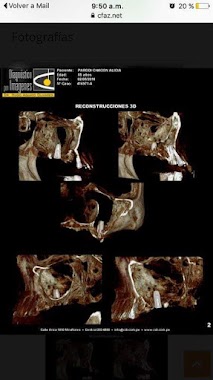 ODONTOLOGIA DR LIMO PAJAR OSCAR ABRAHAM, Author: ODONTOLOGIA DR LIMO PAJAR OSCAR ABRAHAM