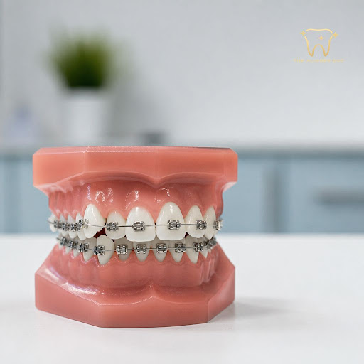 Struggling with crowded, overlapping teeth? At The Aligner Doc Dental Clinic in Kharghar, Navi Mu… post image