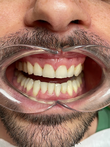Clínica Dental Dra. Carmen Tamarit - Thumbnail