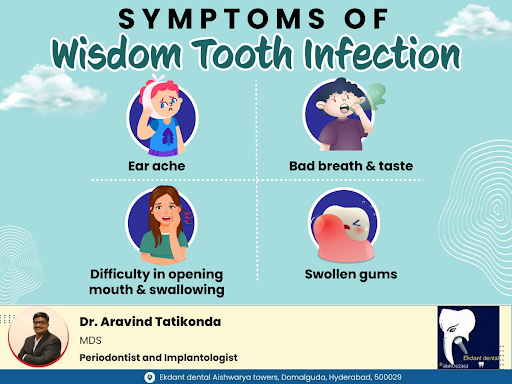 Symptoms of Wisdom Tooth Infection post image
