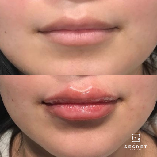 It's A Secret Med Spa