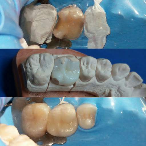 Consultorio Dental. Rehabilitación Oral. - Thumbnail