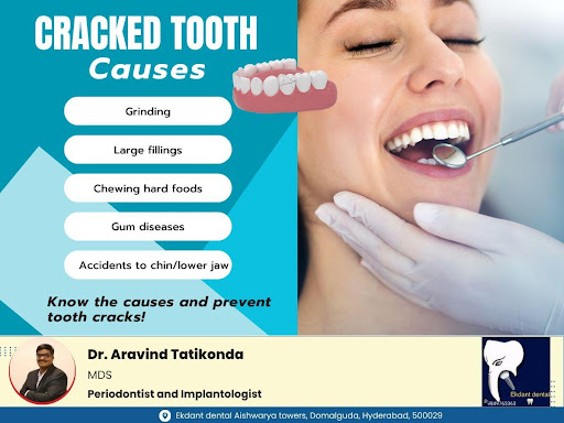 Why Do Teeth Crack? post image