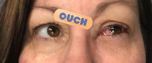 Vita Eye Clinic - Thumbnail