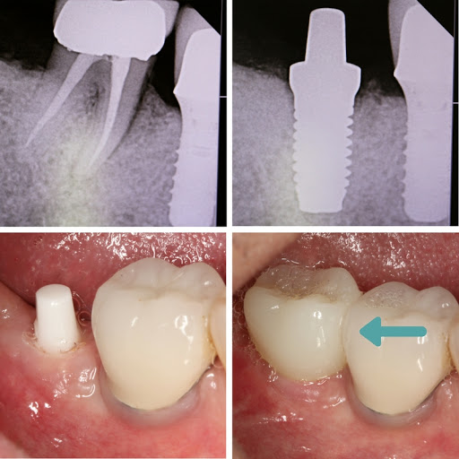 Mission Dental Implant Center - Thumbnail