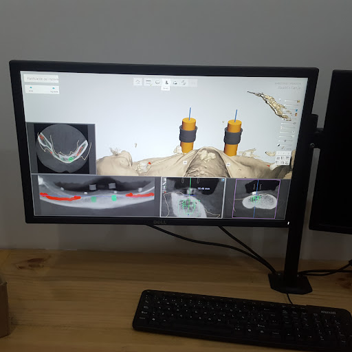 Clínica Dental El Zonte BITCOIN SMILES