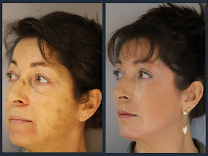 Photo n°7 de CENTRE DE MEDECINE ESTHETIQUE DR PEYRE BIARRITZ à Biarritz (Centre d'épilation laser)