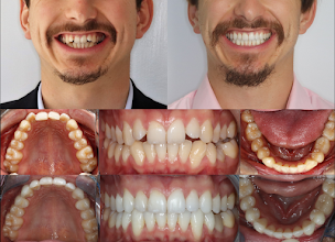 Photo n°22 de Dr Serge Sobol - Chirurgien dentiste - Orthodontie invisible à Lyon (Orthodontiste)