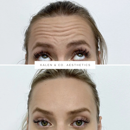 Kalen & Co. Aesthetics