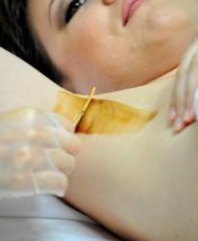 Sugar & Lemon Haarentfernung mit Sugaring in Hilden - Thumbnail