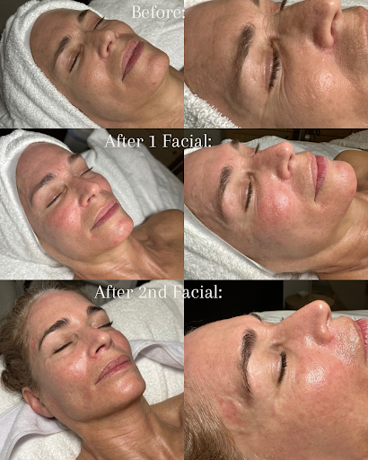 Tru Skin Esthetics