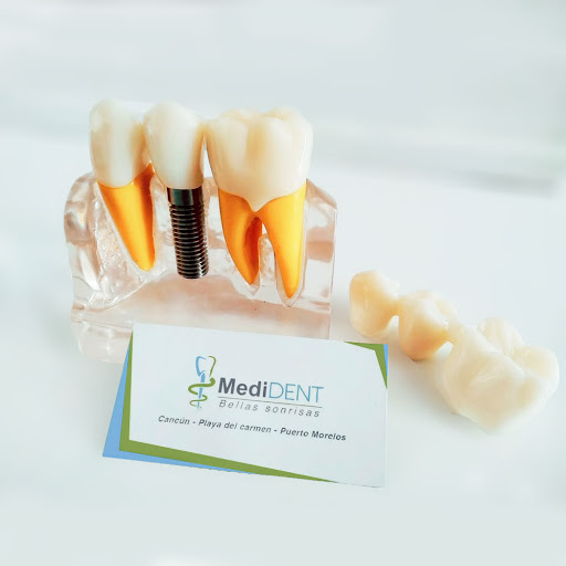 Medident Dentistas Cancún - Thumbnail