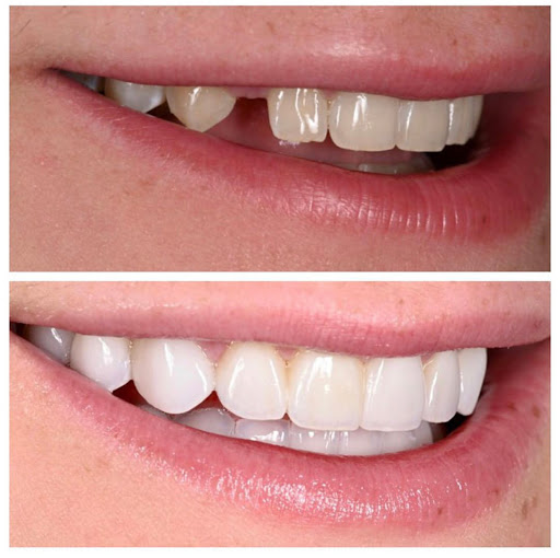 iSmile by Dr. Sonia Olivares - Thumbnail