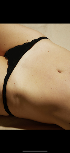 C-Section Correction - Visual