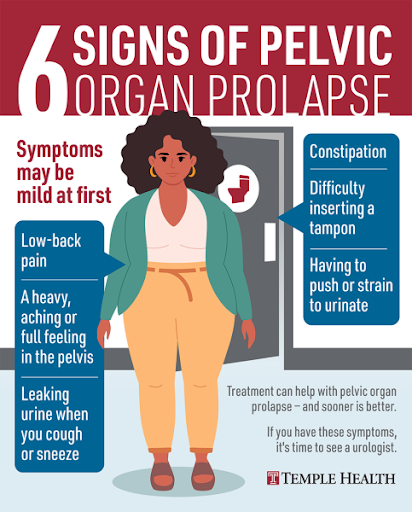 Pelvic organ prolapse is when one or more pelvic organs drop from their position. This makes a bu… post image