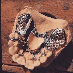 Photo n°7 de Option Prothèse à Beuzeville (Centre de prothèses dentaires)