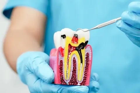 A stubborn toothache can interrupt your day and make even simple tasks difficult. When the inner… post image