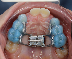 Photo n°10 de Dr. Sofia Trindade ✨ Dentiste Esthétique et Alignement dentaire (Orthodontie) 🦷 Soins Dentaires & Urgences Dentaires 🚨 à Paris (Dentiste)