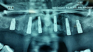 Photo n°26 de Dr Amadeo RAMOS à Sainte-Marie-la-Mer (Dentiste)