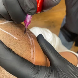 Photo n°18 de G&G Micropigmentation Capillaire - Tricopigmentation - traitement calvitie à Paris (Tatoueur)