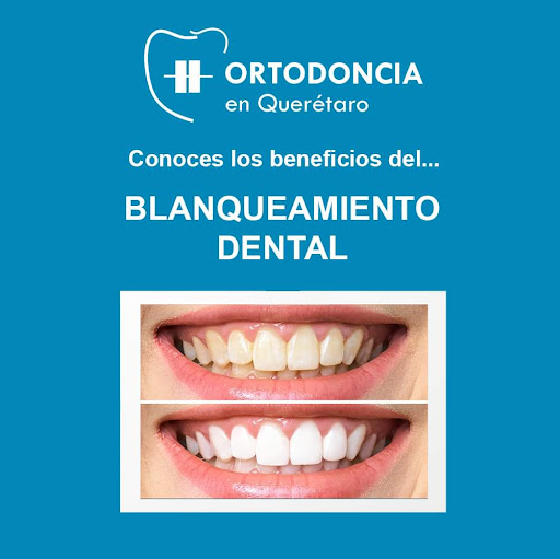 Diodental - Thumbnail
