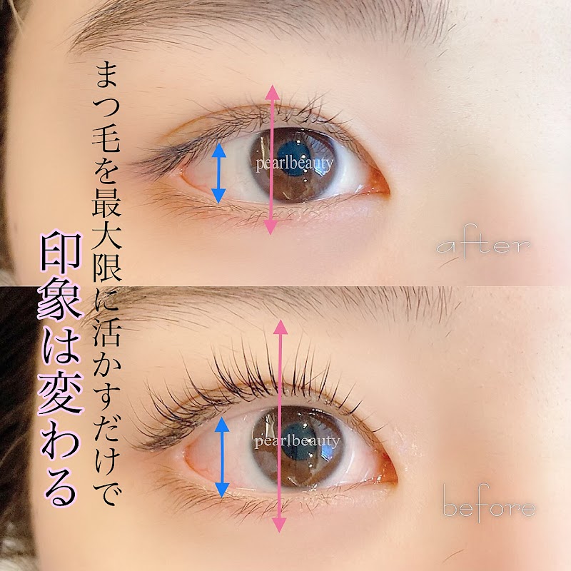 パールビューティー