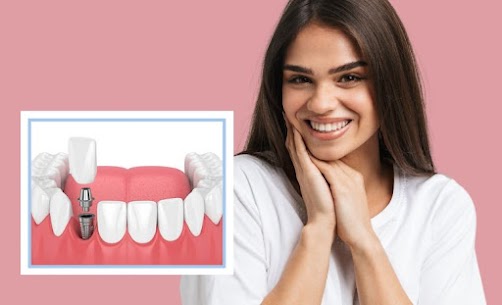 Our expert implantologist, Dr. Sandeep Gophane, provides advanced dental implants in Yavatmal tha… post image