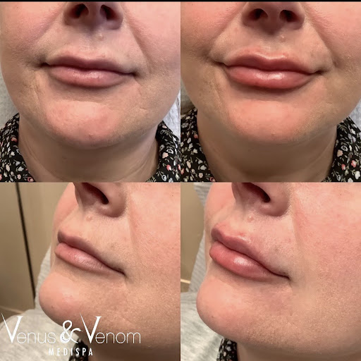 Venus & Venom MEDIspa Monroe - Thumbnail