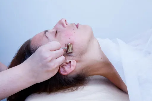 Acupuncture Renée-Lise Lavoie Saint-Constant - Thumbnail