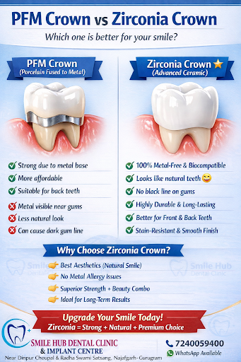 PFM Crown (Porcelain Fused to Metal): post image