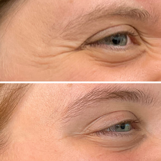 Confident Med Spa - Epping