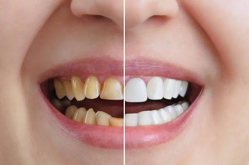 Radiance begins at Vardan Dental Clinic, located in Satellite, Ahmedabad, where we create confide… post image