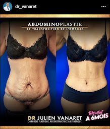 Photo n°3 de Dr J. Vanaret - Chirurgien Esthétique à Saint-Parres-aux-Tertres (Chirurgien plasticien)