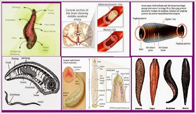 health