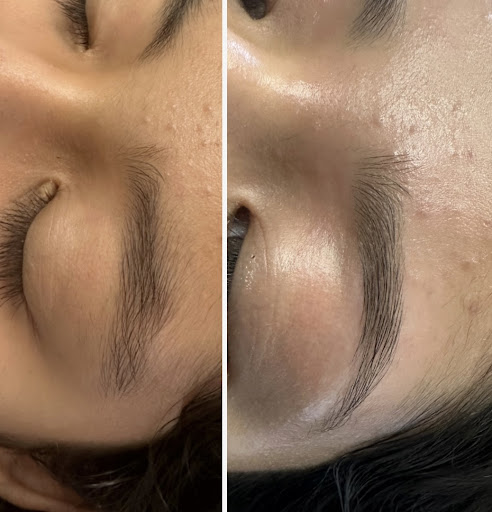 Z beauty - Thumbnail