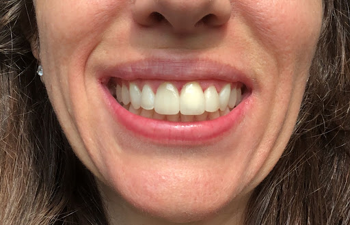 Bianchidenti Studio Di Odontoiatria & Igiene Dentale - Thumbnail
