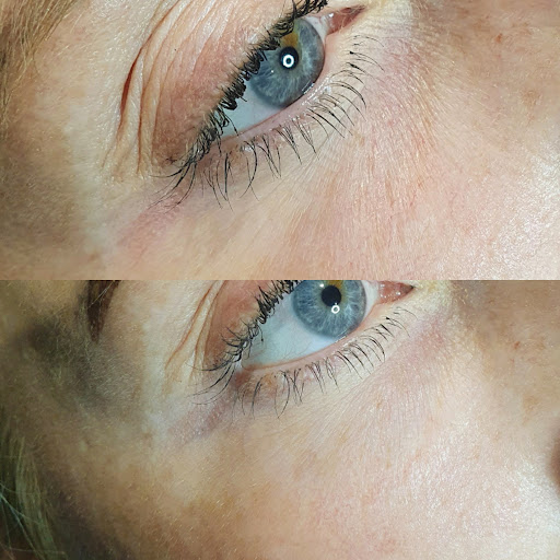 CLH AESTHETICS & BEAUTY Gallery - United Kingdom