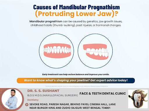 While family history plays a role, factors like jaw growth abnormalities, prolonged childhood hab… post image