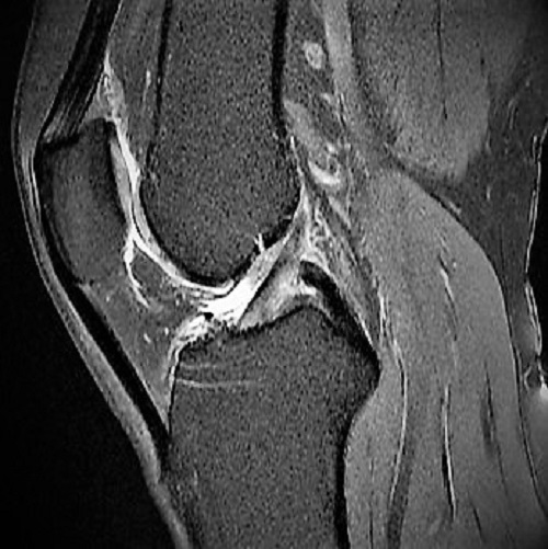Radiologie Norderstedt Dres. Lemke Krüger Schreiter mit Kernspin MRT Mammographie CT DXA Röntgen - Thumbnail