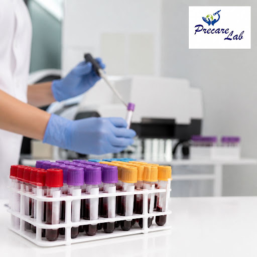 Regular health checkups can catch problems early, before they turn serious. At Precare lab in Sec… post image