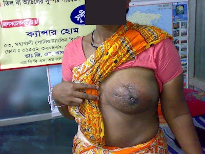 Photos of Cancer home, DR.GM Salam,Best Breast cancer specialist in bangladesh, Rafa .cancer Hospital