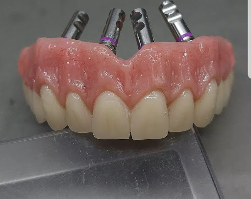 Erreci Dental S.N.C. di Recchia Enrico e Cinelli Enzo