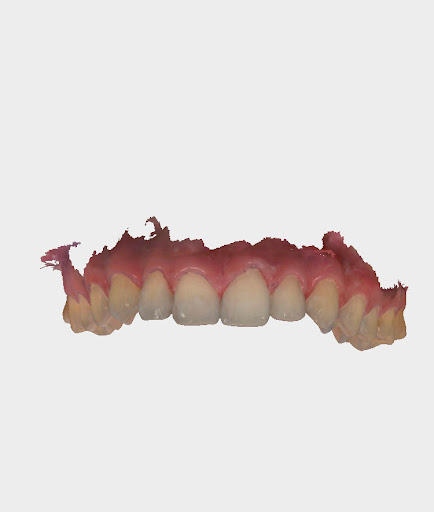Studio Dentistico Dott.ssa Elena Gasparini - Thumbnail