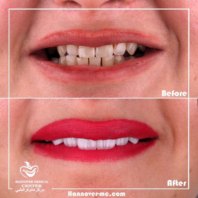 مركز هانوفر الطبي - صورة 2