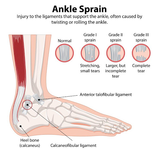 Timely and effective treatment is crucial for a swift recovery. Dr. Varun Ahuja employs a compreh… post image