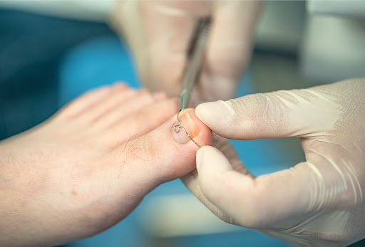Choice Health - Podiatry - Thumbnail
