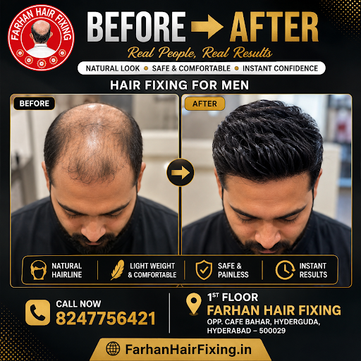 We're committed to providing professional hair fixing and non-surgical hair replacement solutions… post image