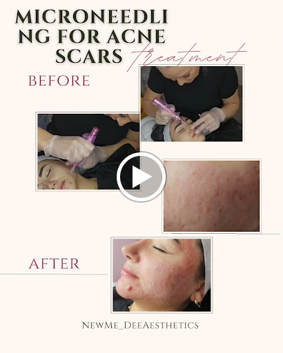 New Me Dee Aesthetics