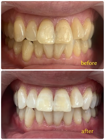 ホワイトニングカフェ市川店